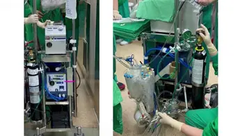 World’s first continuous beating heart transplant